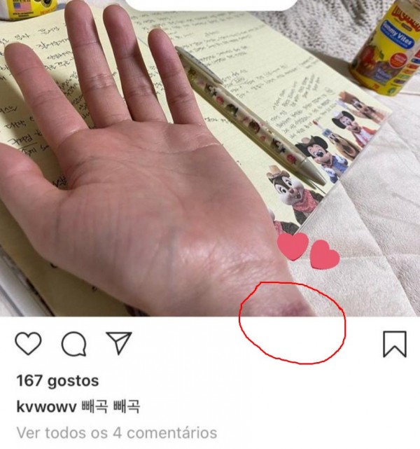 Mantan AOA Mina Mengungkap Tembakan Layar dari DM berbahaya setelah Meninggalkan Band-nya